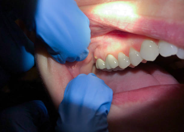  Forest Oaks, NC Emergency Dentist Pros