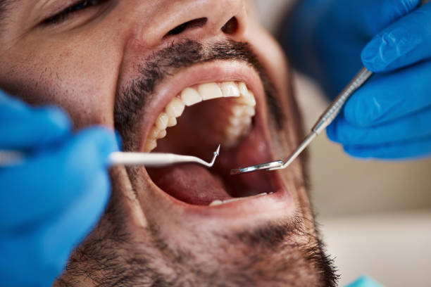 Best Emergency Dental Care for Trauma or Injury in Forest Oaks, NC