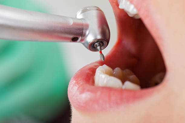 Best After-Hours Emergency Dentist in Forest Oaks, NC